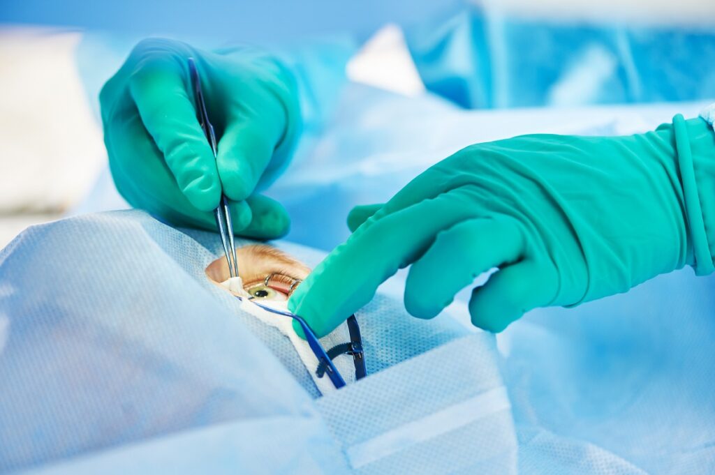 Кератопластика - это сложная операция по пересадке роговой оболочки