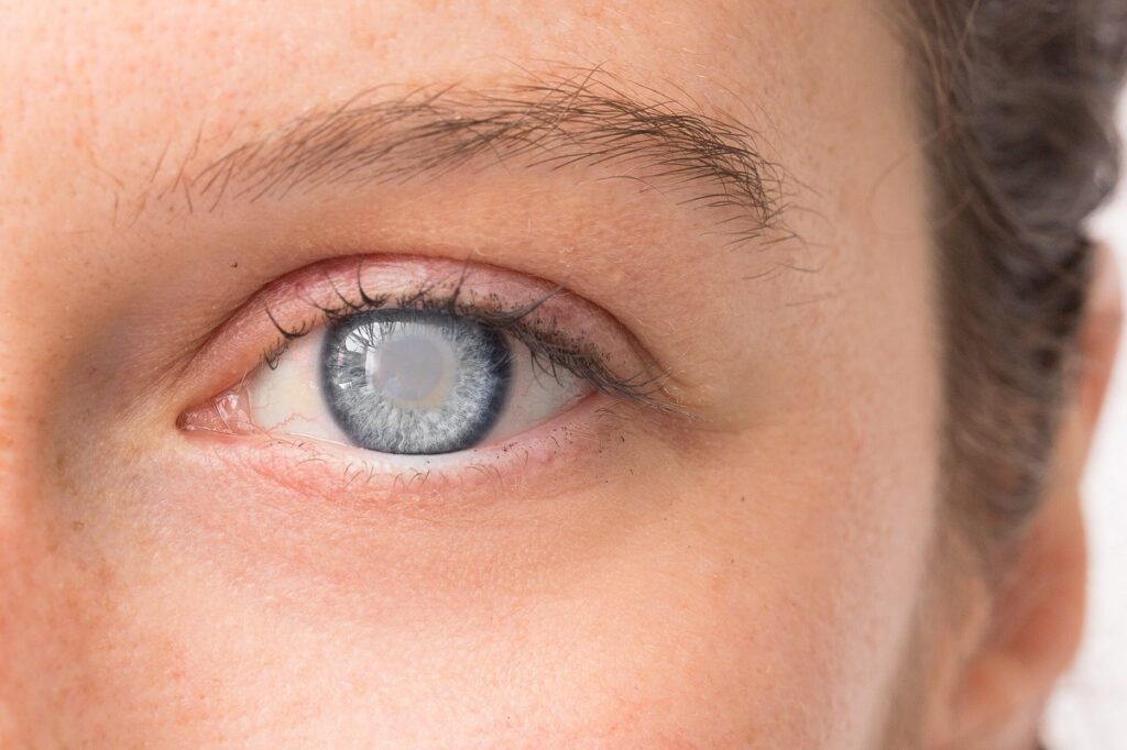 лечение катаракты при кератоконусе