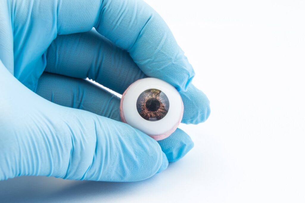 При повреждении роговицы, когда потеря эндотелиальных клеток, вызванная операцией по удалению катаракты, слишком велика и оставшиеся эндотелиальные клетки не могут взять на себя функцию восстановления, единственным решением является трансплантация.
